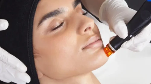 So-Young provides cosmetic services